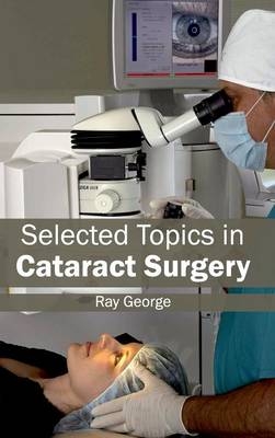 Selected Topics in Cataract Surgery - 