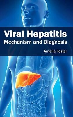 Viral Hepatitis: Mechanism and Diagnosis - 