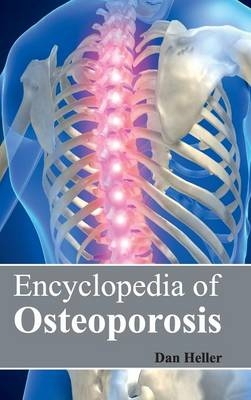Encyclopedia of Osteoporosis - 