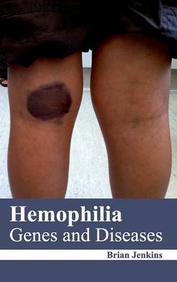 Hemophilia: Genes and Diseases - 