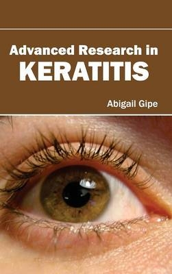 Advanced Research in Keratitis - 