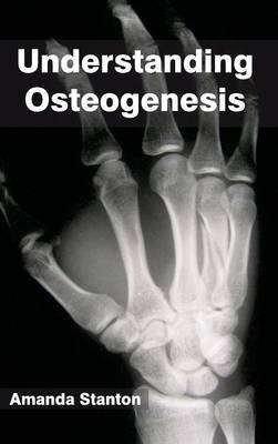 Understanding Osteogenesis - 