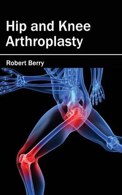 Hip and Knee Arthroplasty - 
