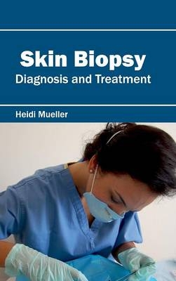 Skin Biopsy: Diagnosis and Treatment - 