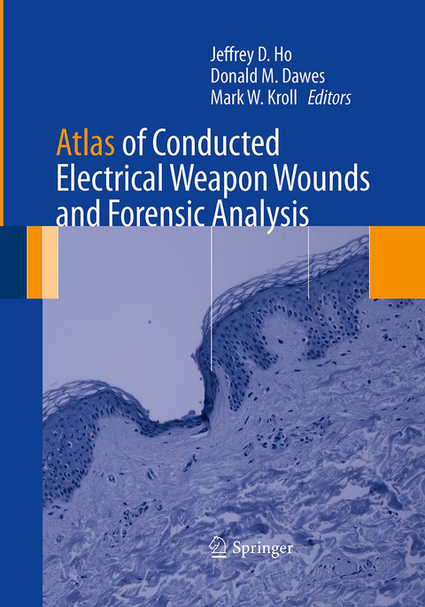 Atlas of Conducted Electrical Weapon Wounds and Forensic Analysis - 