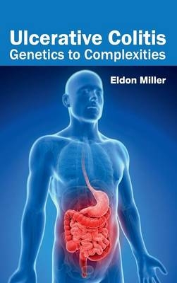 Ulcerative Colitis: Genetics to Complexities - 