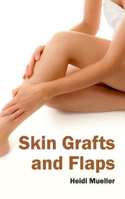 Skin Grafts and Flaps - 