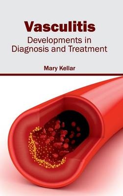 Vasculitis: Developments in Diagnosis and Treatment - 