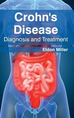 Crohn's Disease: Diagnosis and Treatment - 