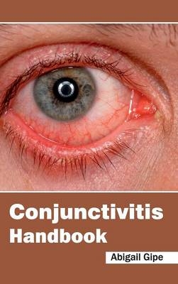 Conjunctivitis Handbook - 