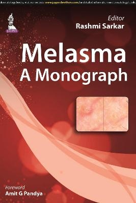 Melasma: A Monograph - Rashmi Sarkar