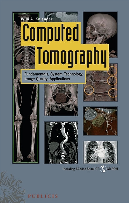 Computed Tomography - Willi A Kalender