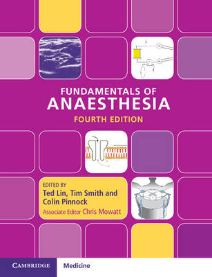 Fundamentals of Anaesthesia - 