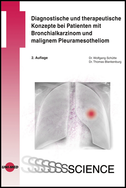 Diagnostische und therapeutische Konzepte bei Patienten mit Bronchialkarzinom und malignem Pleuramesotheliom - Wolfgang Schütte, Thomas Blankenburg