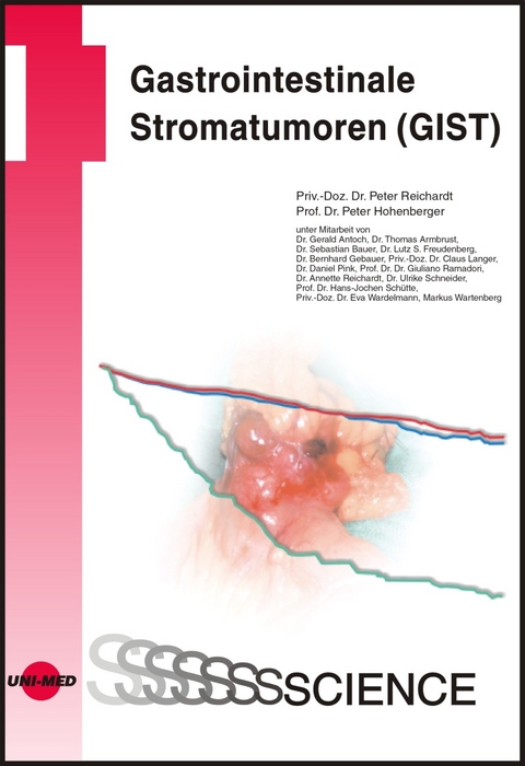 Gastrointestinale Stromatumoren (GIST) - Peter Reichardt, Peter Hohenberger