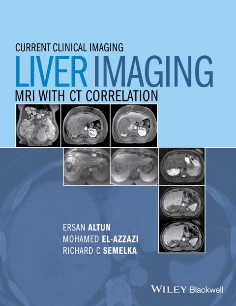 Liver Imaging - Larissa Braga