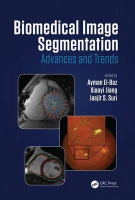 Biomedical Image Segmentation - 