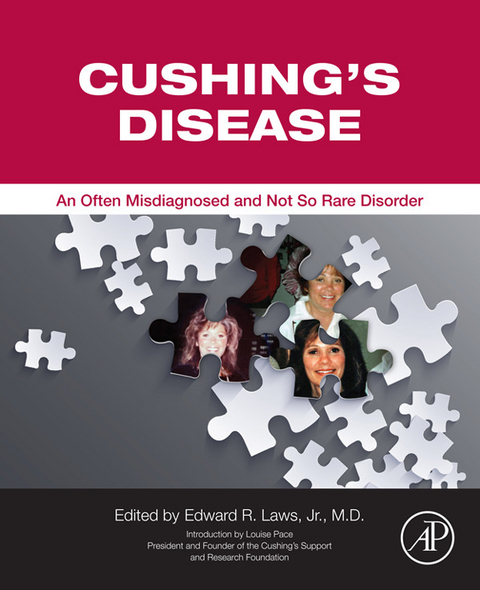 Cushing's Disease - 