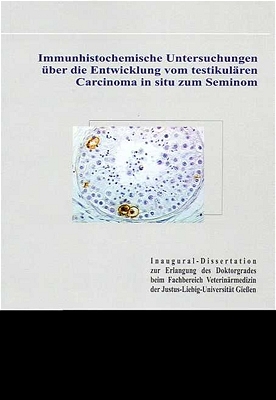 Immunhistochemische Untersuchungen über die Entwicklung vom testikulären Carcinoma in situ zum Seminom - Judith Donner