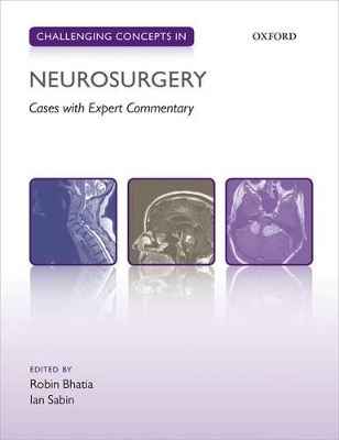 Challenging Concepts in Neurosurgery - 