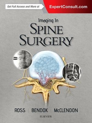 Imaging in Spine Surgery -  Bernard R. Bendock,  Jamal McClendon Jr.,  Jeffrey S. Ross