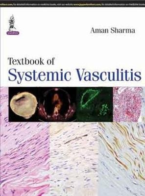 Textbook of Systemic Vasculitis - Aman Sharma