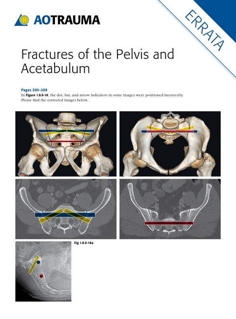 Fractures of the Pelvis and Acetabulum (AO) - Marvin Tile, David L. Helfet, James F. Kellam, Mark S. Vrahas
