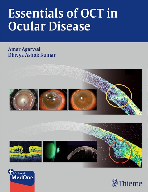 Essentials of Oct in Ocular Disease - Dr Amar Agarwal, Dhivya Ashok Kumar