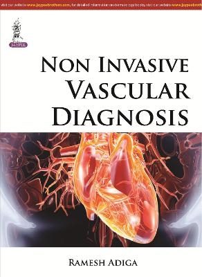 Non Invasive Vascular Diagnosis - Ramesh Adiga