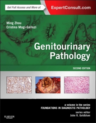 Genitourinary Pathology - Ming Zhou, Cristina Magi-Galluzzi