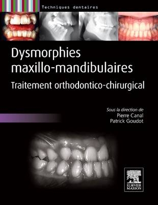 Dysmorphies Maxillo-Mandibulaires - Pierre Canal, Patrick Goudot