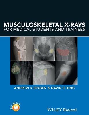 Musculoskeletal X-Rays for Medical Students and Trainees - Andrew Brown, David G. King