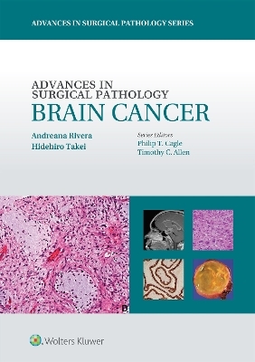 Advances in Surgical Pathology: Brain Cancer - Andreana Rivera, Hidehiro Takei