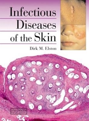 Infectious Diseases of the Skin - Dirk Elston