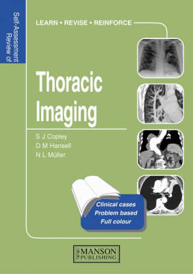 Thoracic Imaging - Sue Copley, David M. Hansell, Nestor L Müller