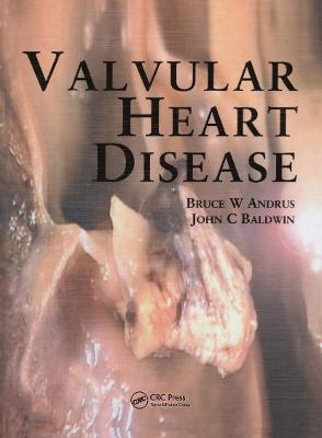 Valvular Heart Disease - Bruce Andrus, John Baldwin