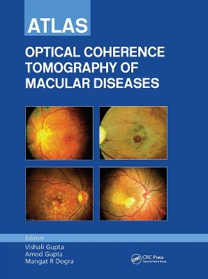 Atlas of Optical Coherence Tomography of Macular Diseases - Vishali Gupta, Amod Gupta, Mangat R. Dogra