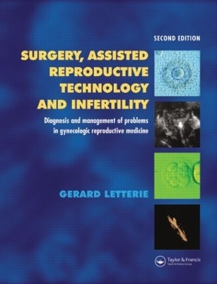 Surgery, Assisted Reproductive Technology and Infertility - Gerard S. Letterie