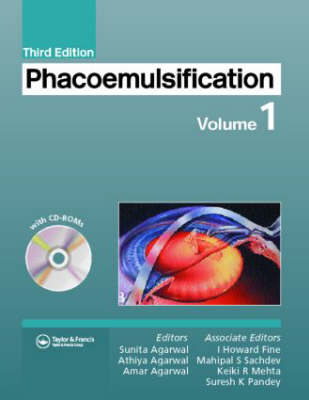 Phacoemulsification - 