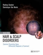 Hair and Scalp Disorders - Rodney P. R. Dawber, Dominique Van Neste