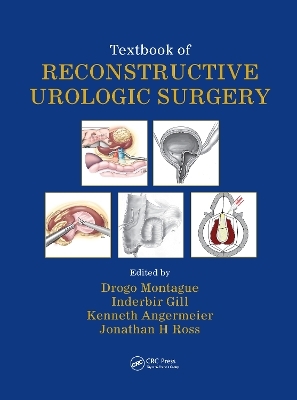 Textbook of Reconstructive Urologic Surgery - 
