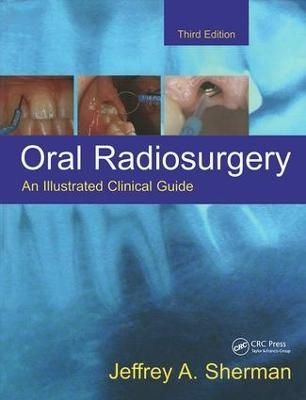 Oral Radiosurgery - Jeffrey A. Sherman
