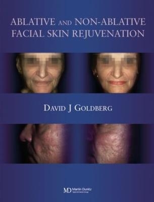 Ablative and Non-ablative Facial Skin Rejuvenation - David J. Goldberg