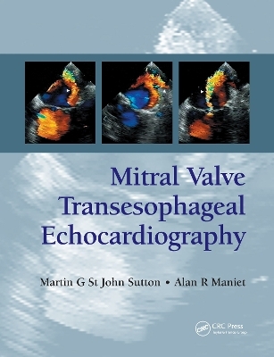 Mitral Valve Transesophageal Echocardiography - Martin G. St. John Sutton, Alan R. Maniet