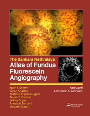 Atlas of Fundus Fluorescein Angiography - Nitin Shetty