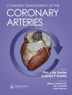 Computed Tomography of the Coronary Arteries - de Feyter Pim, G. P.  Gabriel Krestin