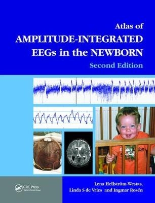 An Atlas of Amplitude-Integrated EEGs in the Newborn - 