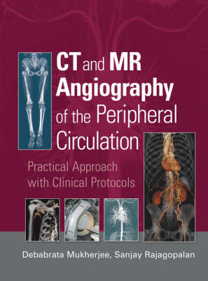 CT and MR Angiography of the Peripheral Circulation - 