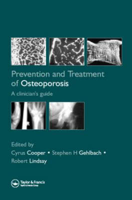 Prevention and Treatment of Osteoporosis in the High-Risk Patient - 