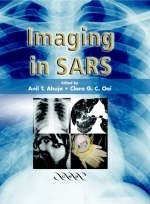 Imaging in SARS - 